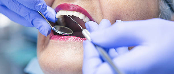 Best Emergency Dental Care for Broken or Chipped Teeth in Stanley, NC